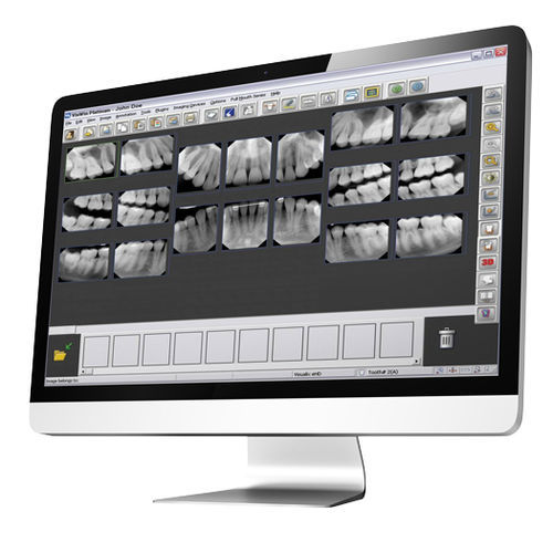 Software medico - Gendex™ VixWin™ Platinum - DEXIS - odontoiatrico / di gestione / di visualizzazione