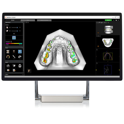 Modulo software di modelizzazione - CS Model - DEXIS - ortodontico / di analisi / di pianificazione del trattamento