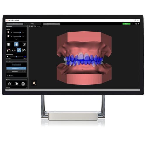Modulo software di modelizzazione - CS Model+ - DEXIS - di analisi / di pianificazione del trattamento / ortodontico