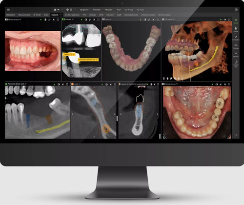 Software clinico - DTX™ Studio - DEXIS - odontoiatrico / per imaging odontoiatrico / di gestione