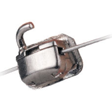 Tubo vestibolare molari - SnapLink™ - Ormco - convertibile
