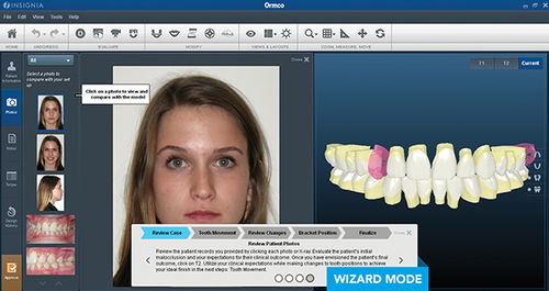 Software per ortodonzia - Insignia™ Ai - Ormco - di progettazione digitale del sorriso