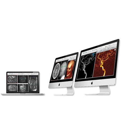 Software di post elaborazione - aycan Medical Systems - di visualizzazione 3D / diagnostico / di valutazione