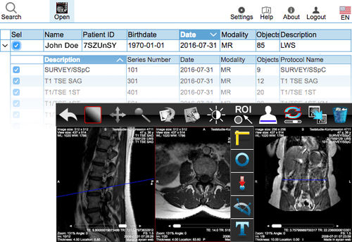 Applicazione web di condivisione - aycan Medical Systems - di visualizzazione DICOM / per diagnostica per immagini / basata sul web