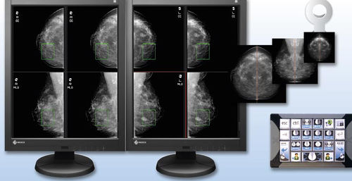 Modulo software per mammografia - aycan Medical Systems - di visualizzazione / di gestione dati