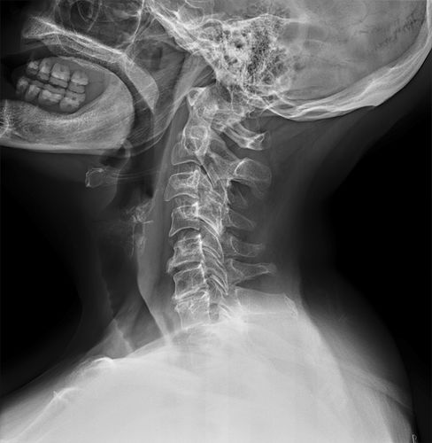 Software per radiografia - Altumira™  - ContextVision - per angiografia / di ottimizzazione delle immagini