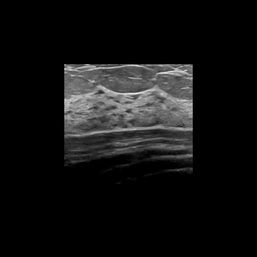 Software di ottimizzazione delle immagini - Rivent™  - ContextVision - clinico / per ecografia / cardiovascolare