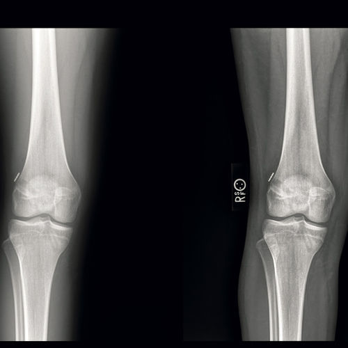Software per radiografia - ContextVision - per imaging ortopedico / ortopedico / di visualizzazione