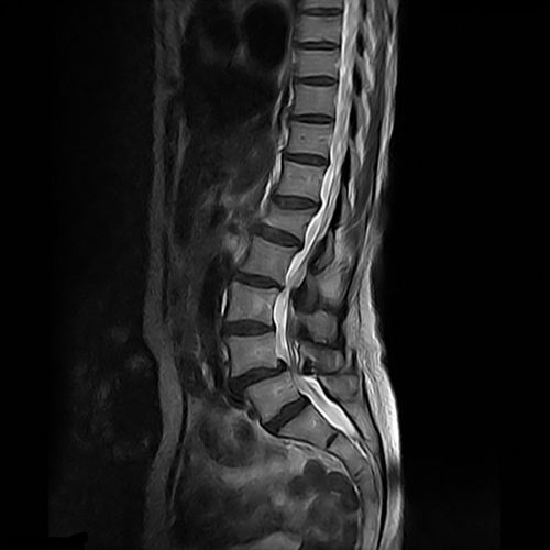 Software di visualizzazione - GOPView MRI2Plus - ContextVision - MRI