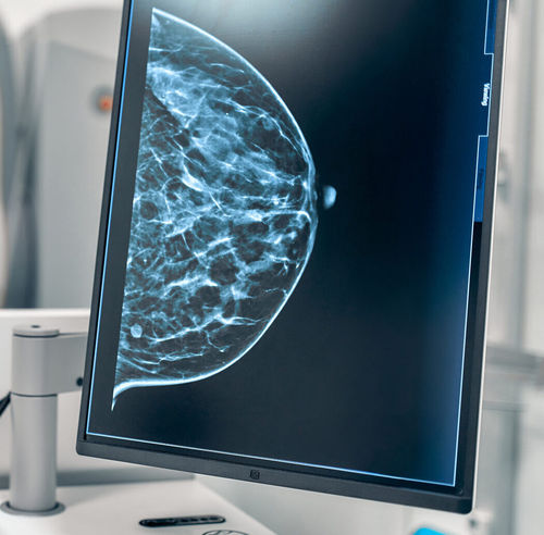 Algoritmo diagnostico - ProFound AI® - iCAD - di analisi / di trattamento / di rilevamento