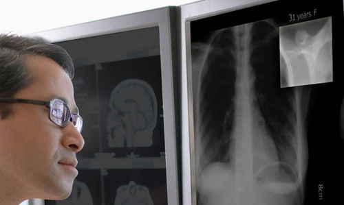 Software diagnostico - CFS™ - Double Black Imaging - di monitoraggio / di calibrazione / per monitor medicali