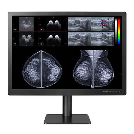 Monitor medico - GEMINI-12MP - Double Black Imaging - diagnostico / 31" / LCD