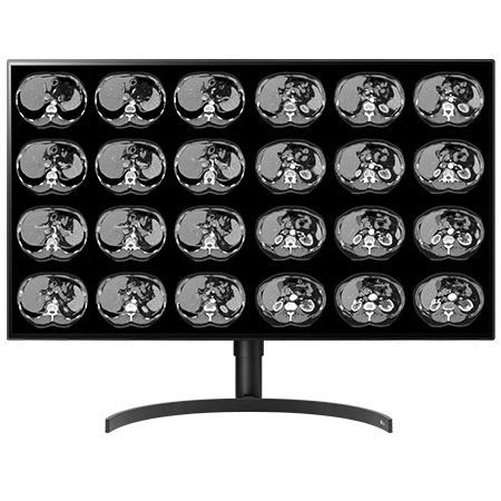 Monitor medico - CL8MPS32C - Double Black Imaging - diagnostico / 3840 × 2160 / 32"