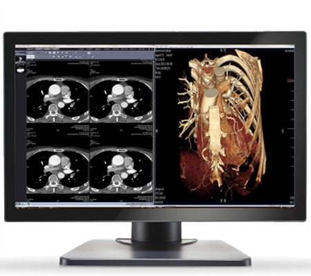 Monitor medico - GEMINI-4MP - Double Black Imaging - 30" / LED / DVI