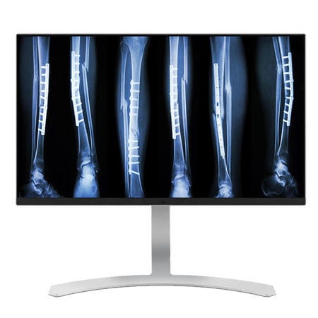 Monitor medico - CL8MPS - Double Black Imaging - diagnostico / 3840 × 2160 / 27"