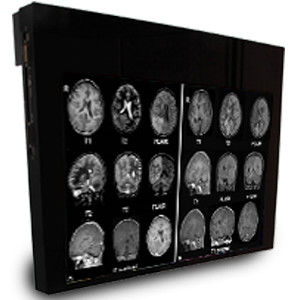 Monitor medico - DBI32 - Double Black Imaging - 1920x1200 / 32" / LED