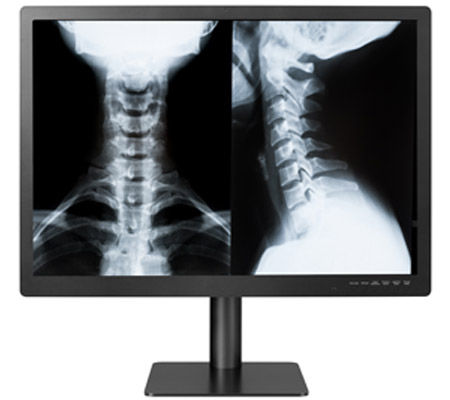 Monitor medico - GEMINI-8MP - Double Black Imaging - diagnostico / 3840 × 2160 / 31.5"