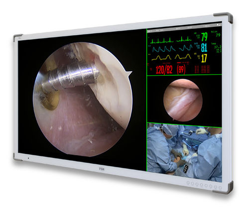 Monitor medico - C55SF - Double Black Imaging - chirurgico / Full HD / 3840 × 2160