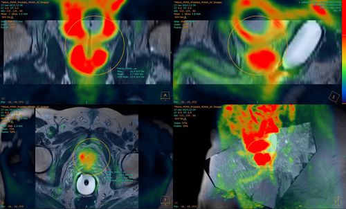 Software clinico - Fusion Technology™ - Hermes Medical Solutions, Inc - per tomografia computerizzata / TEP / SPECT