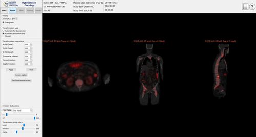 Software clinico - SUV SPECT® - Hermes Medical Solutions, Inc - per tomografia computerizzata / SPECT / di controllo qualità