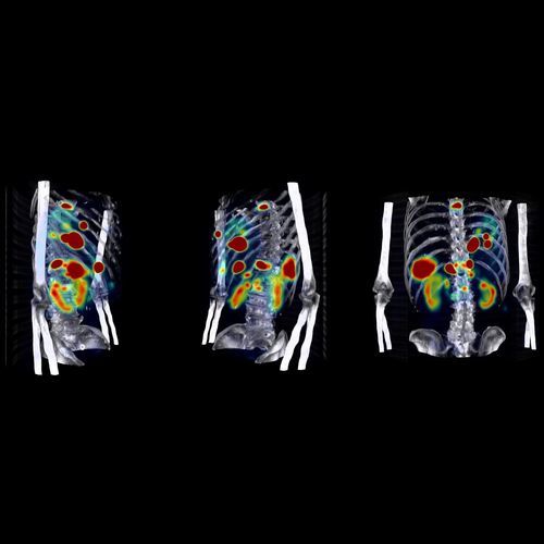 Software diagnostico - Theranostics - Hermes Medical Solutions, Inc - di trattamento / medico