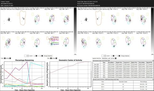 Software di analisi - Hermes Medical Solutions, Inc - per gastroenterologia