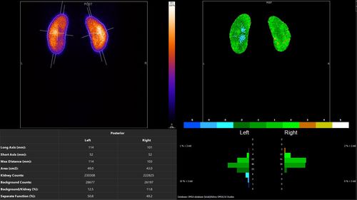 Software di analisi - Hermes Medical Solutions, Inc - per reportistica / di acquisizione / SPECT