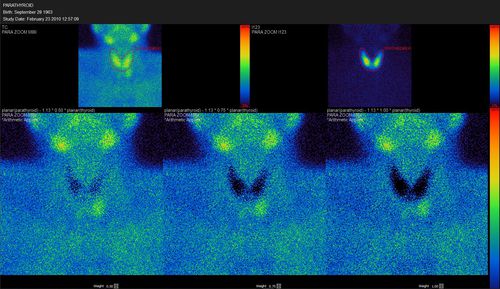 Software visualizzatore - Hermes Medical Solutions, Inc - di quantificazione / SPECT / sistema endocrino