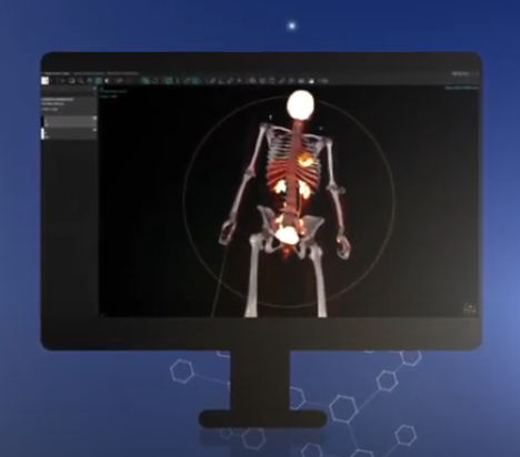Software per reportistica - vendor-neutral - Hermes Medical Solutions, Inc - clinico / per tomografia computerizzata / TEP