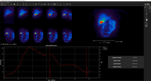 Software di analisi - Hermes Medical Solutions, Inc - medico / per chirurgia / di fegato