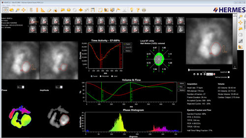 Software di analisi - Hermes Medical Solutions, Inc - per reportistica / diagnostico / di acquisizione