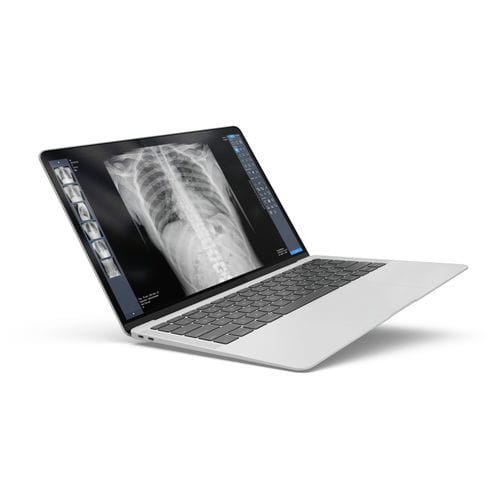 Software per radiografia - ExamVue Duo - JPI Healthcare Solutions - di analisi / di gestione / diagnostico