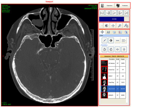 Software di file DICOM - Ultima Digital Illuminator - Medsquare - per sala operatoria / di visualizzazione / di scambio dati