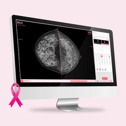 Software medicale per mammografia - VXvue Mammo - Vieworks - di gestione / visualizzatore / di acquisizione