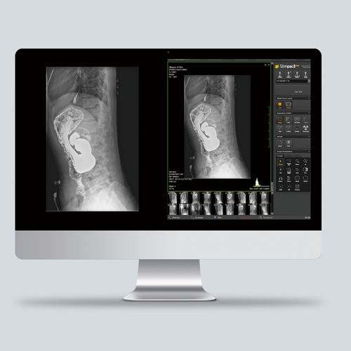 Software per radiografia - Slimpac Ⅱ Plus - Vieworks - di controllo / visualizzatore / diagnostico