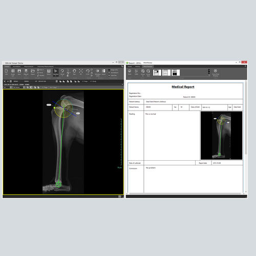 PACS per diagnostica per immagini - QXLink3 - Vieworks