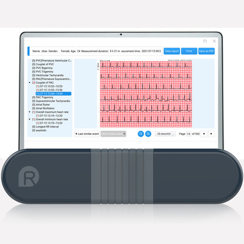 Holter 1 canale - HeartView - Shenzhen Viatom Technology Co., Ltd.