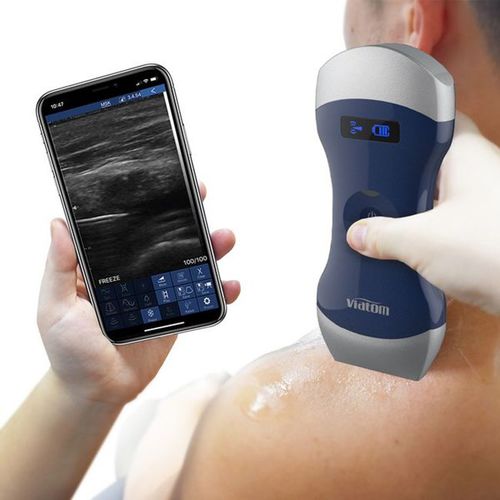 Ecografo palmare - Uprobe-C 4PL - Shenzhen Viatom Technology Co., Ltd. - per ecografia multidisciplinare / in bianco e nero / con doppler a colori