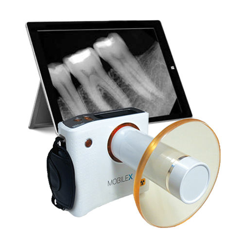 Sistema di radiografia intraorale analogico/digitale - MobileX  - Denterprise - portatile