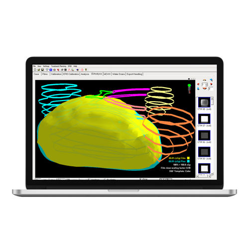 Software per radioterapia - RAy™ - Standard Imaging - di gestione della dose irradiata / di analisi / di monitoraggio di dosi di radiazioni