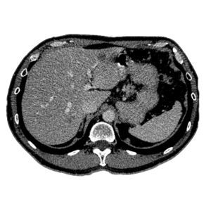 Software di trattamento - MeVis Medical Solutions AG - didattico / medico / per diagnostica per immagini