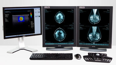 Software di analisi - MeVis Medical Solutions AG - diagnostico / di pianificazione / CAD