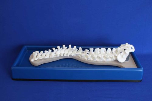 Modello anatomico di colonna vertebrale - SDEP - Créaplast - per scoliosi