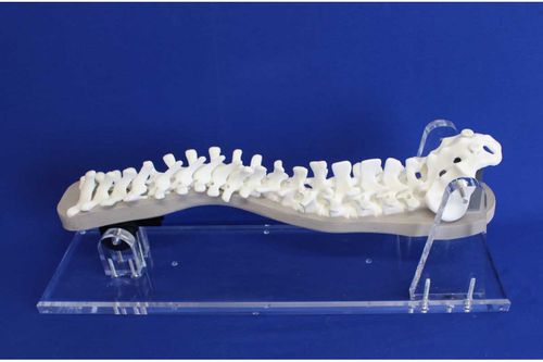 Modello anatomico di colonna vertebrale - S3DEP - Créaplast - ad uso didattico / per scoliosi