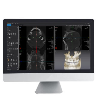 Software di analisi - Dentiq 3D - 3D Industrial Imaging, Co., Ltd. - di visualizzazione 3D / diagnostico / di pianificazione del trattamento