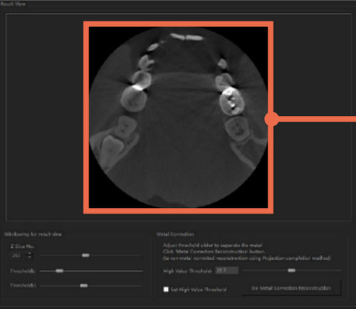 Software di analisi delle immagini - DentiqRecon - 3D Industrial Imaging, Co., Ltd. - medico / per tomografia computerizzata