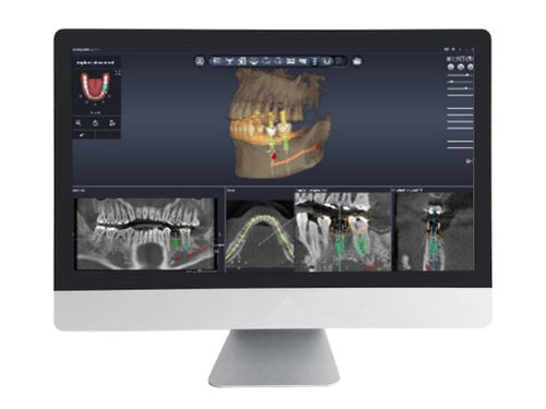 Software di pianificazione - Dentiq Guide - 3D Industrial Imaging, Co., Ltd. - di gestione dati / di progettazione / di acquisizione
