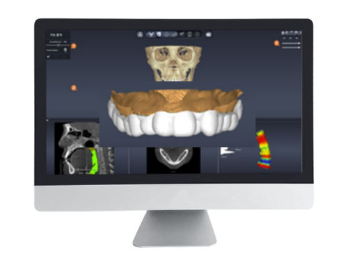 Software di progettazione - DentiqAir - 3D Industrial Imaging, Co., Ltd. - medico / odontoiatrico