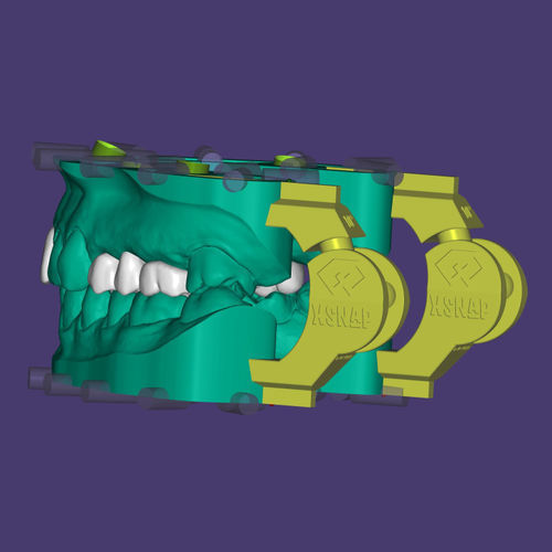 Modulo software per implantologia dentale - xSNAP® - Champions Implants GmbH - di modelizzazione