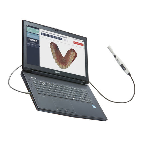 Scanner 3D per clinica odontoiatrica - CONDOR - Condor - intraorale